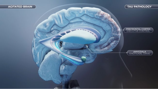 Human brain